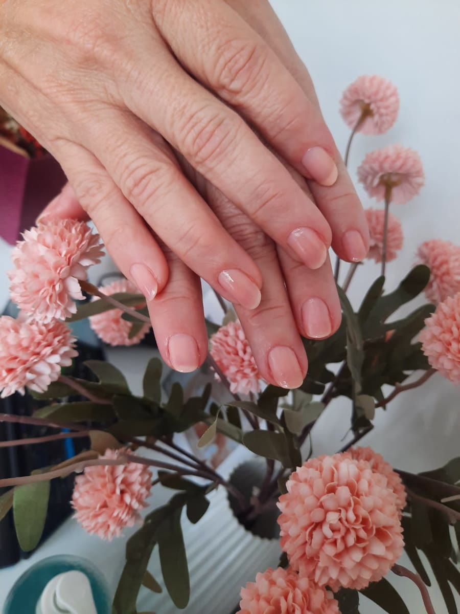Manicure finalizada na clínica