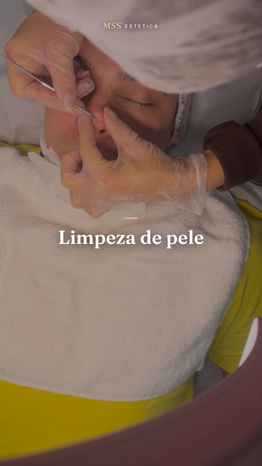 Limpeza de pele em atendimento